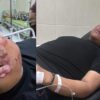 Janji Lapor Polisi, UMI Siap Pecat Pengeroyok Mahasiswa Fikom, Tak Ada Realisasi, Rekan Korban Kecewa